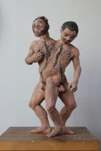 Karin Frank: Conjoined twins